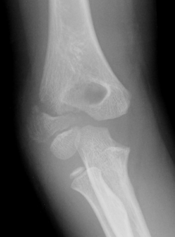 Milch II xray