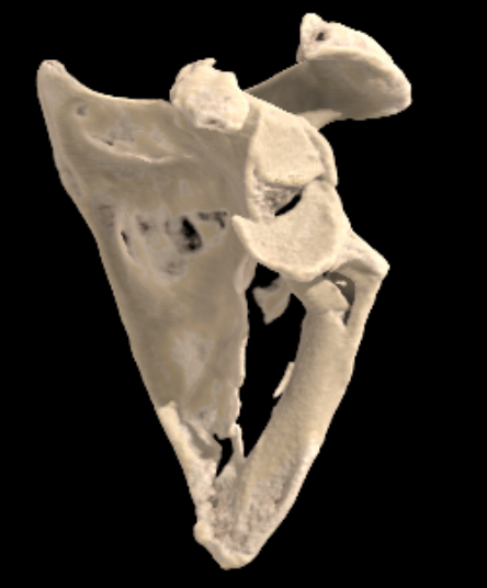 Scapula