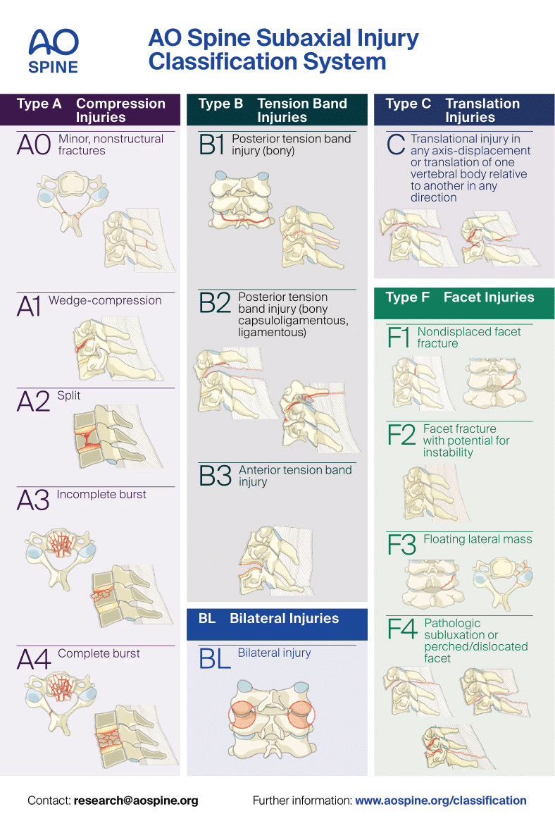 AOSpine Injury Classification