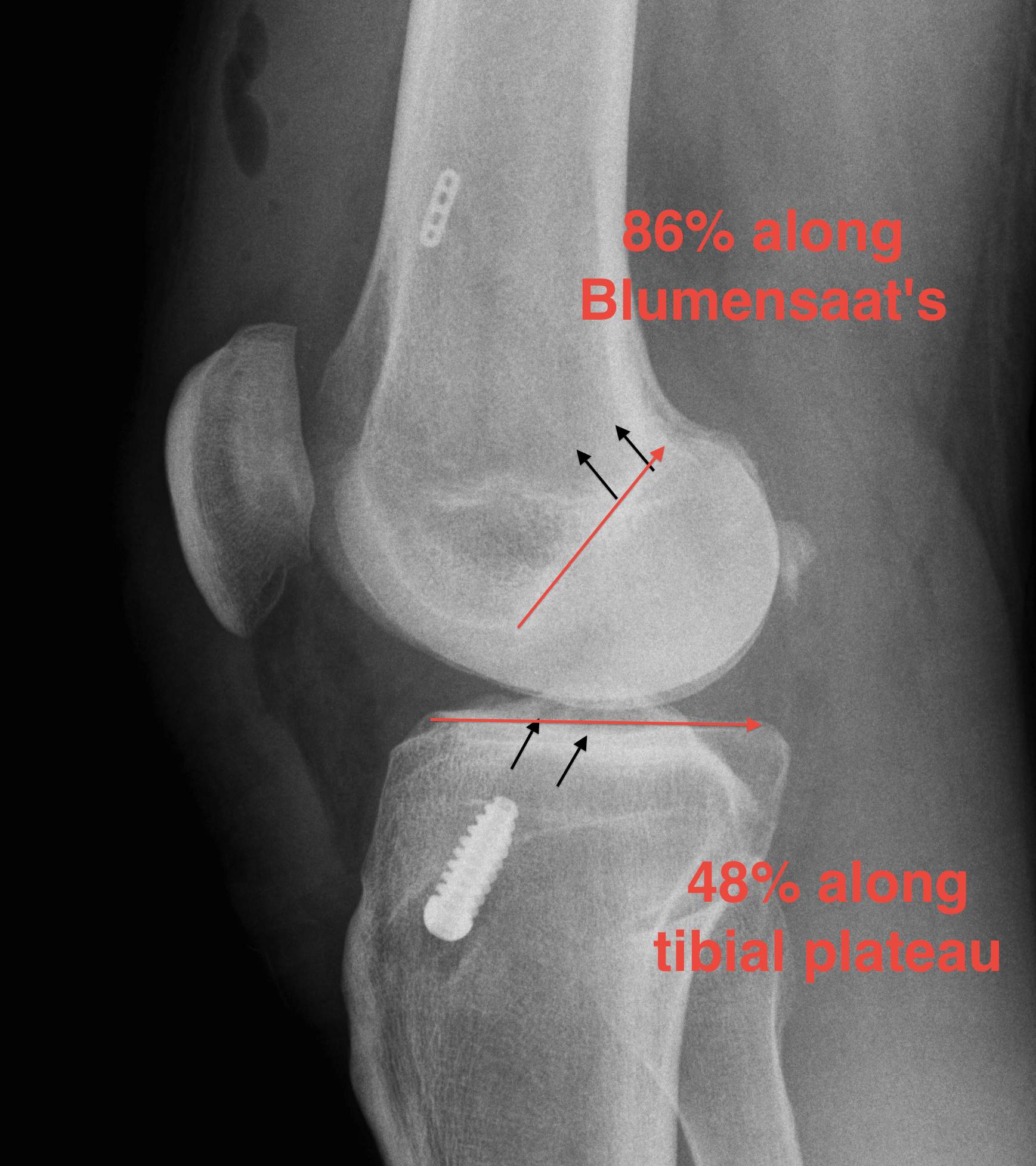 Surgical Reconstruction Issues | The Bone School