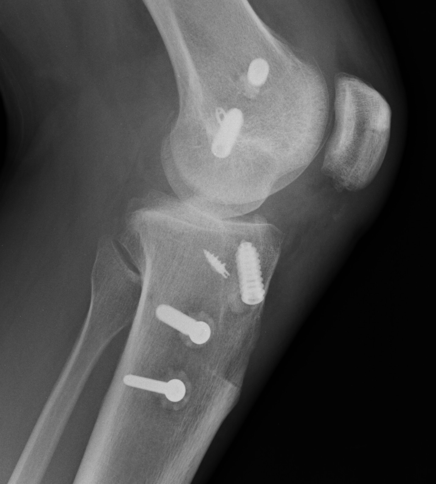 Surgical management | The Bone School