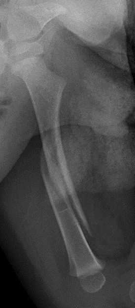 1 month old femur