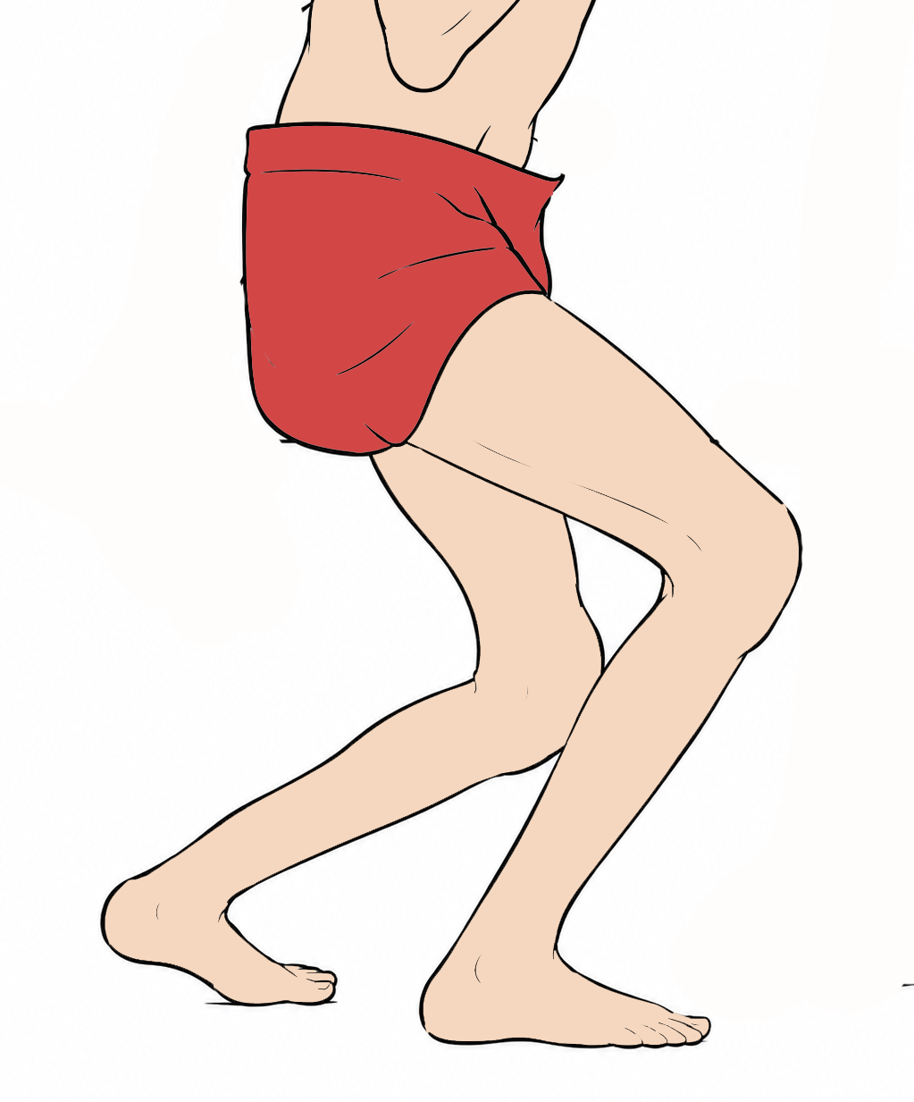 Crouch gait