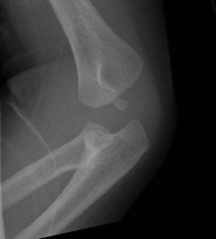 Centers of Ossification | The Bone School