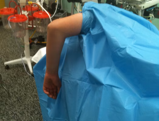 Elbow Lateral Decubitus