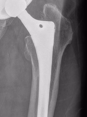 Spot weld