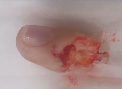 Digit 1