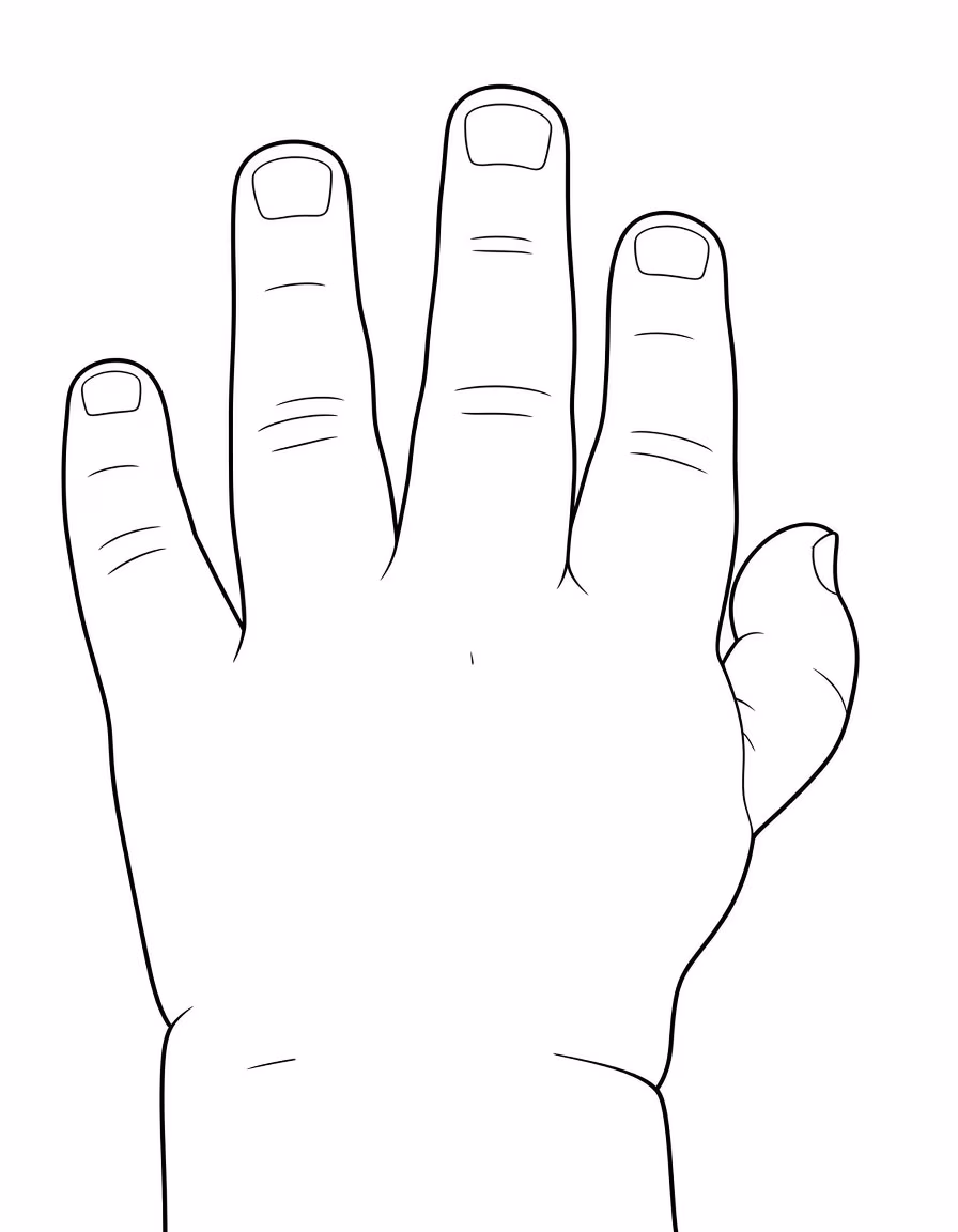 hypoplastic thumb