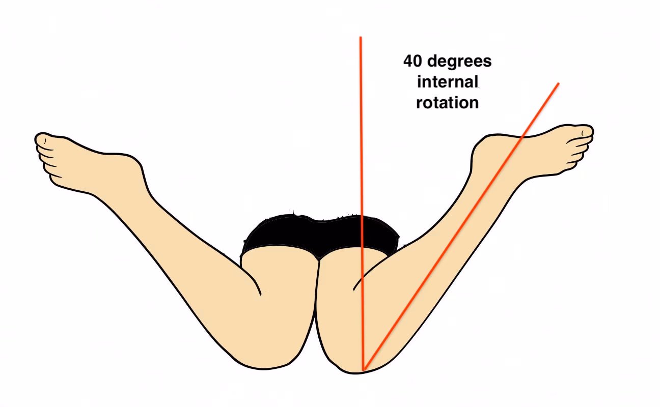 hip internal rotation