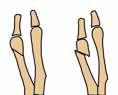 Weil