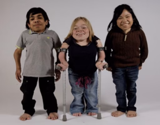 Morquio's syndrome