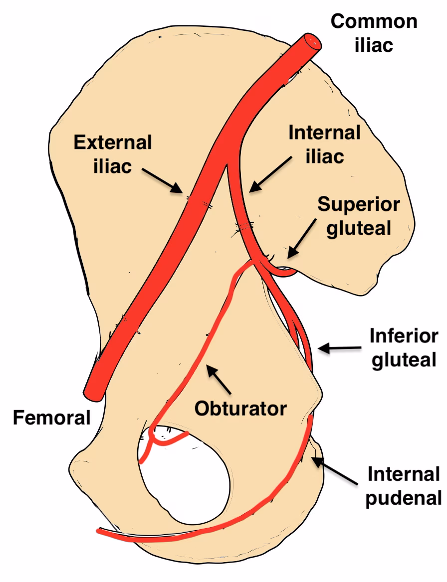 vascular injury