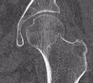 Subcapital NOF Garden 1 CT