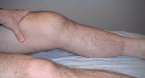 Knee FFD Fixed