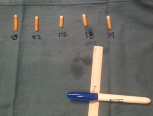 Mosaicplasty Plugs 2