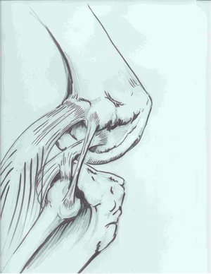 Posterolateral Corner Anatomy 