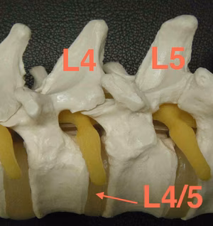 Lumbar Intervertebral Foramen