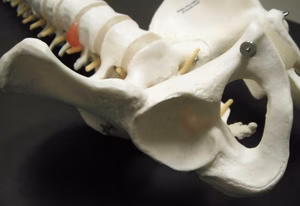 Acetabulum Anterior Column