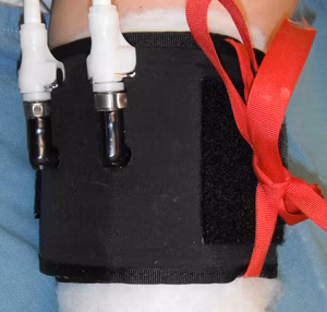 Tourniquet Arm
