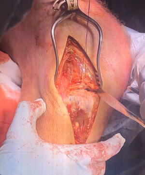 Anterolateral Approach Knee