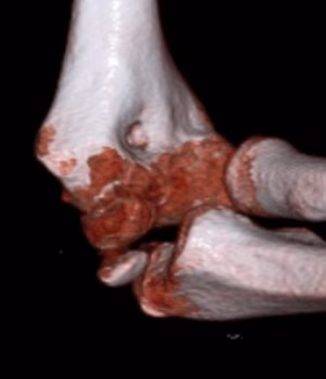 med epi