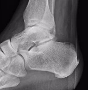 Posterior process