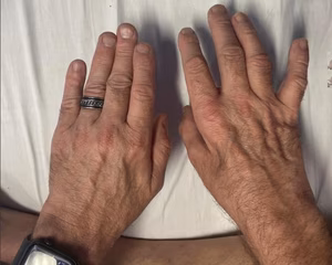 Finger escape