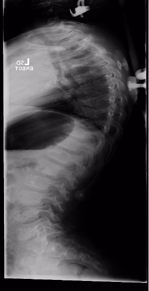 SED Spine