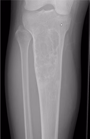 OFDys xray 1