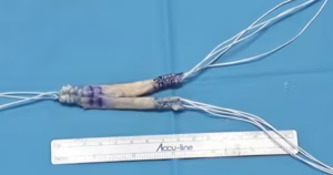 Double bundle PCL graft