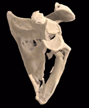 Scapula
