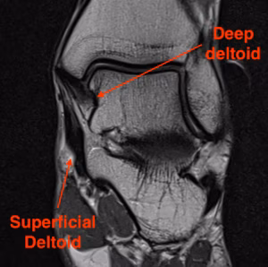 Deltoid