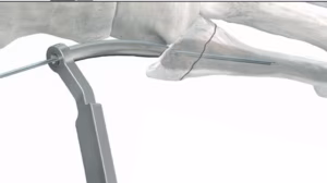 IM 