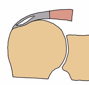 partial