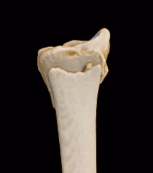 extraarticular