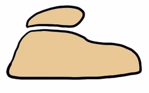 Trochleoplasty