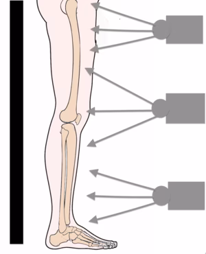 xray
