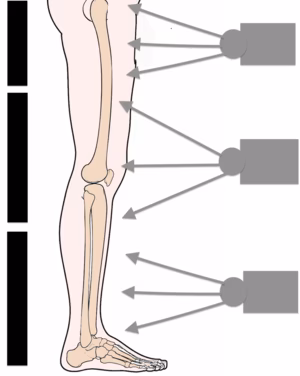 xray