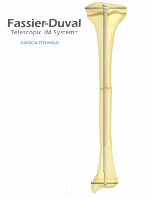 Fassier-Duval