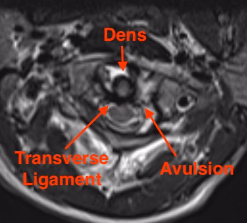 Jefferson MRI 2