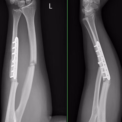 Per #