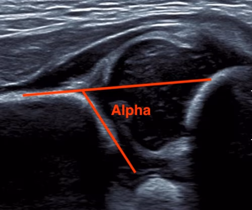 Alpha