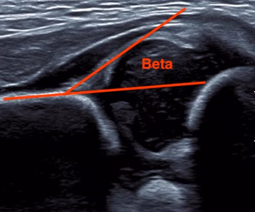 beta