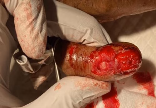Dorsal skin loss