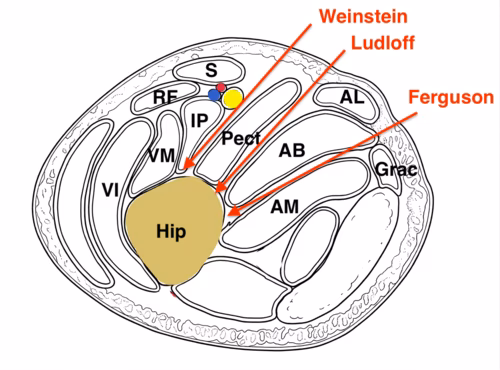 Medial approach