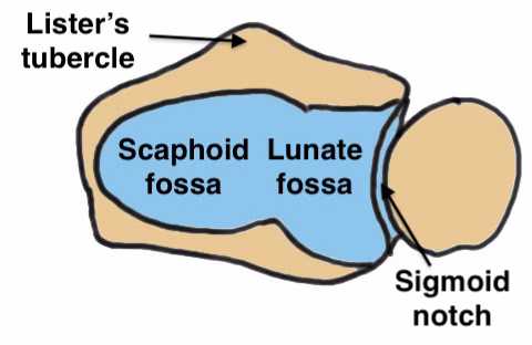 Sigmoid notch