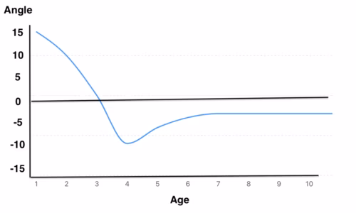 Salenius curve