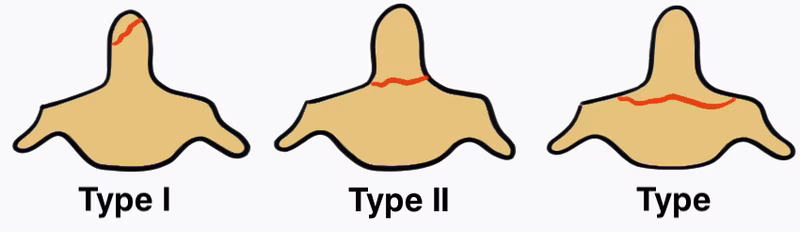 Anderson Classification