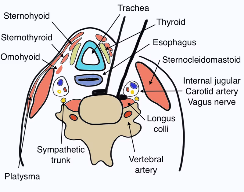 Anterior approach subaxial spine