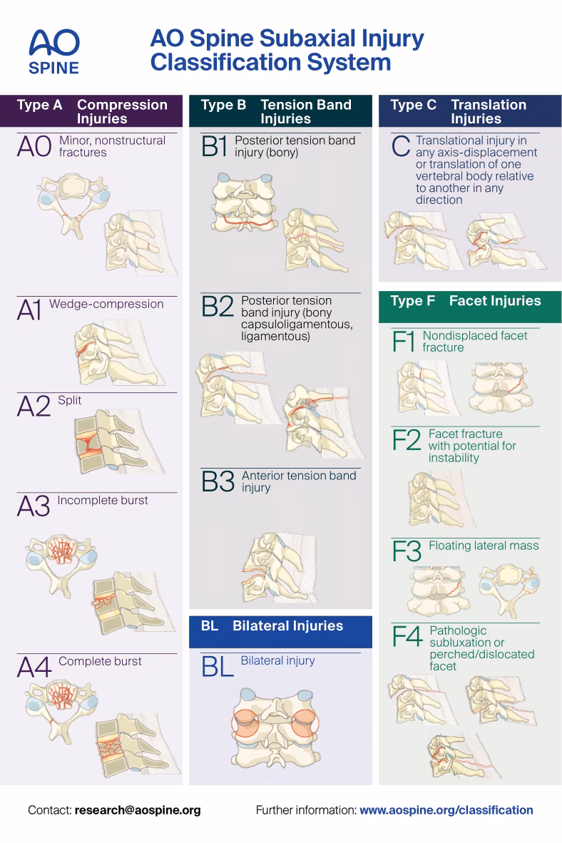 AOSpine Injury Classification